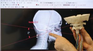 radiografia anatomica