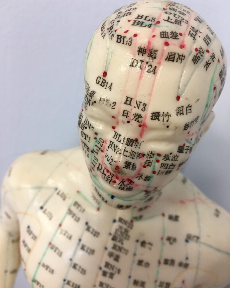 acupuncture-4207760_1280 medicina tradizionale cinese