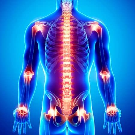 mesoterapia antalgica
